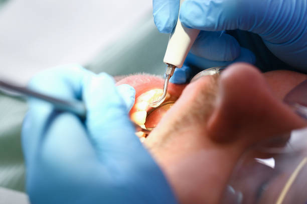 Best Broken or Cracked Tooth Emergency Dentist in West Bishop, CA