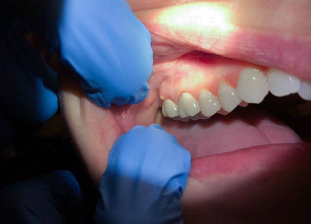 Best Weekend Emergency Dentist in West Bishop, CA