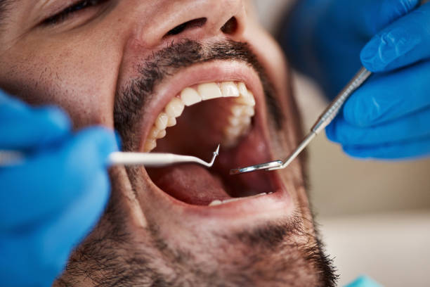 Best Emergency Cosmetic Dentistry in West Bishop, CA