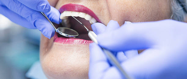 Best Emergency Dental Care for Abscessed Tooth in West Bishop, CA